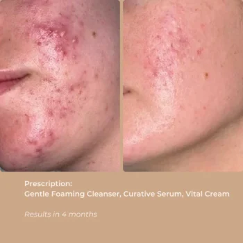 VITAL CREAM - 50 ML - Image 3