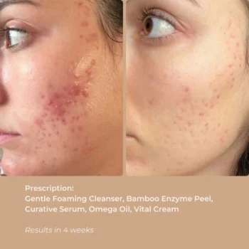 BAMBOO ENZYME PEEL - 50 ML - Image 3