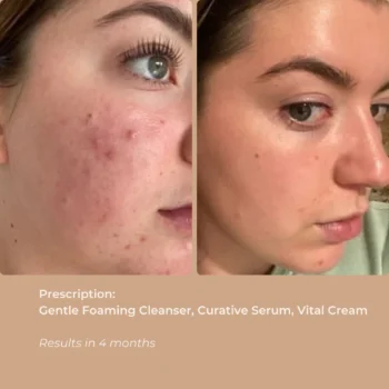 CURATIVE SERUM - 30 ML - Image 3