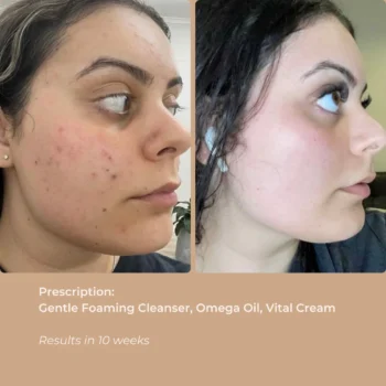 GENTLE FOAMING CLEANSER - 150 ML - Image 3