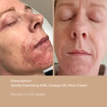 OMEGA OIL SERUM - 30 ML - Image 3