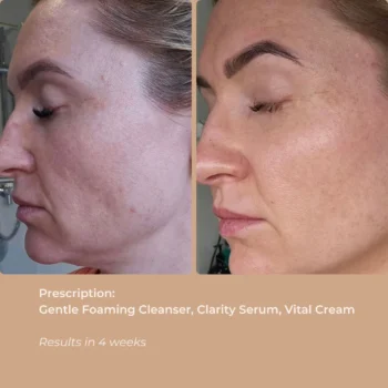 CLARITY SERUM - 30 ML - Image 3